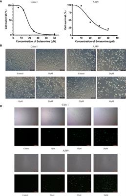 Solasonine Causes Redox Imbalance and Mitochondrial Oxidative Stress of Ferroptosis in Lung Adenocarcinoma